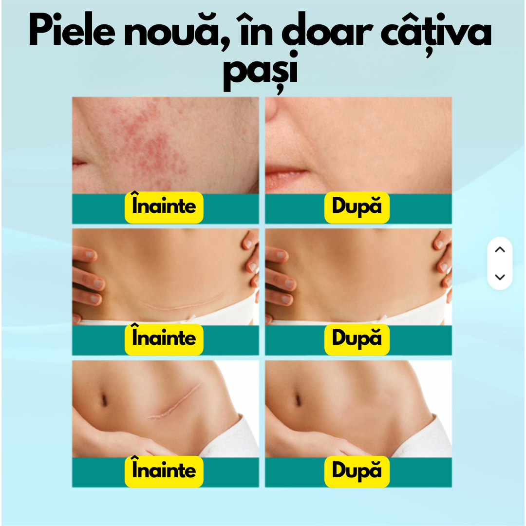 CicaStop – Spray Anti-Cicatrici