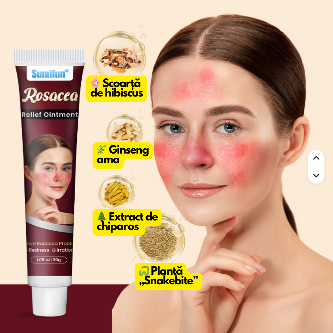RosaCalm – Cremă pentru roșeață și cuperoză