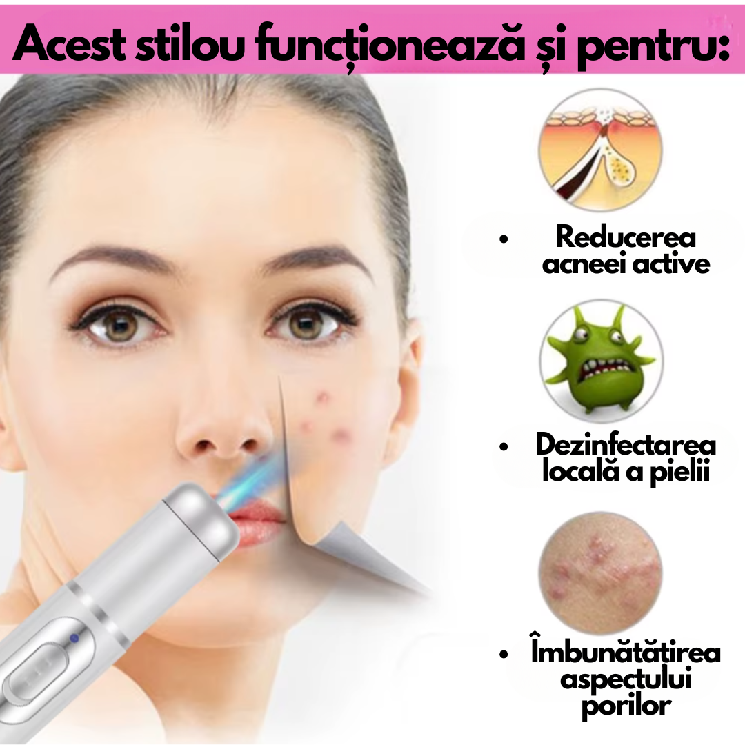 LumiDerm – Stiloul cu lumină UV, ANTI-NEGI