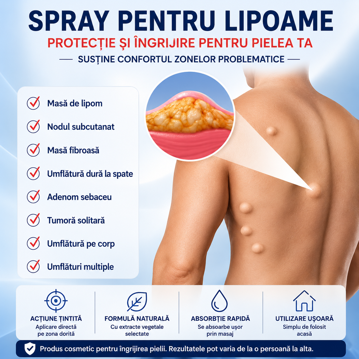 LipoDerm™ – Spray pentru Lipoame și Noduli Subcutanați