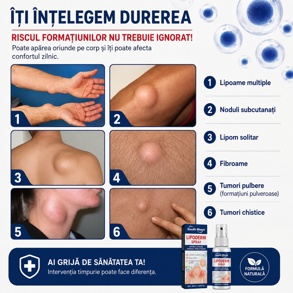 LipoDerm™ – Spray pentru Lipoame și Noduli Subcutanați