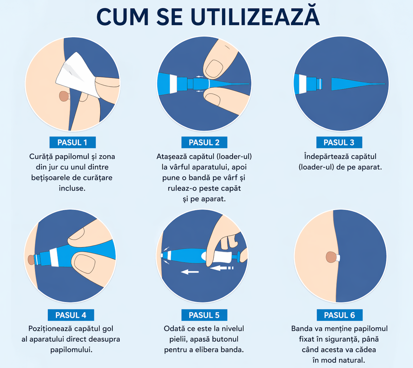 DermaFix Pro – Aparat pentru Papiloame
