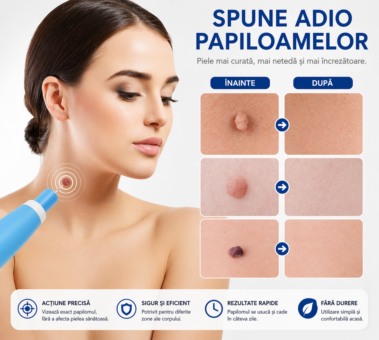 DermaFix Pro – Aparat pentru Papiloame