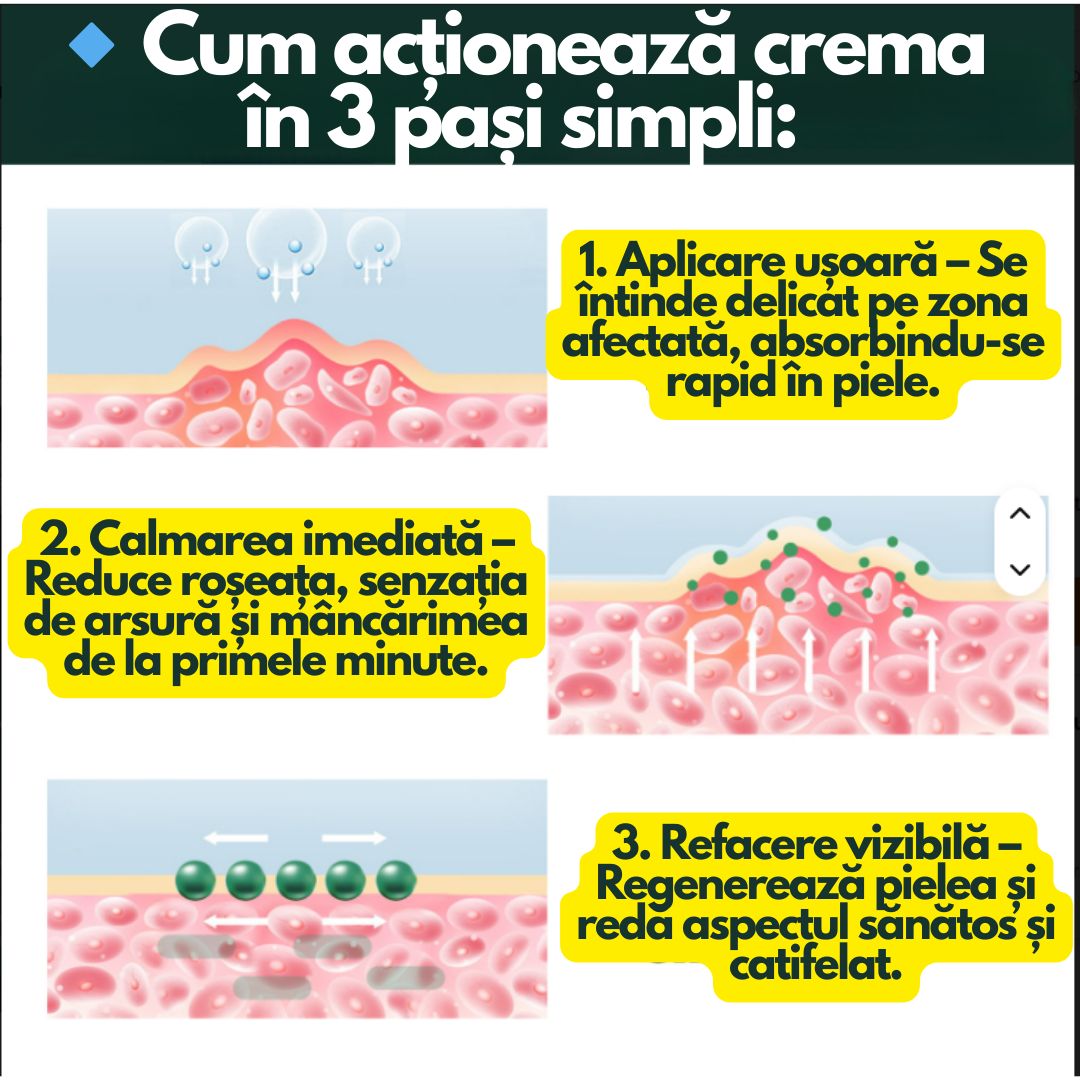 PsoriaCalm – Cremă pentru Psoriazis și Eczeme