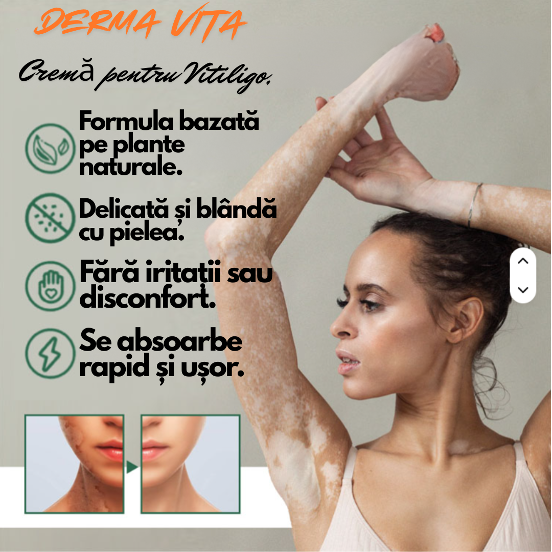 Derma Vita – Cremă pentru Vitiligo
