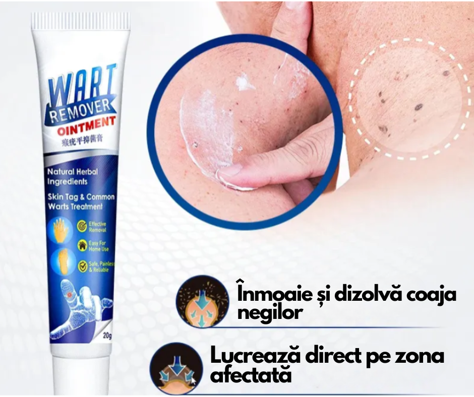 WartRemover - Crema Anti Negi