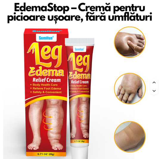 EdemaStop – Cremă pentru picioare ușoare, fără umflături