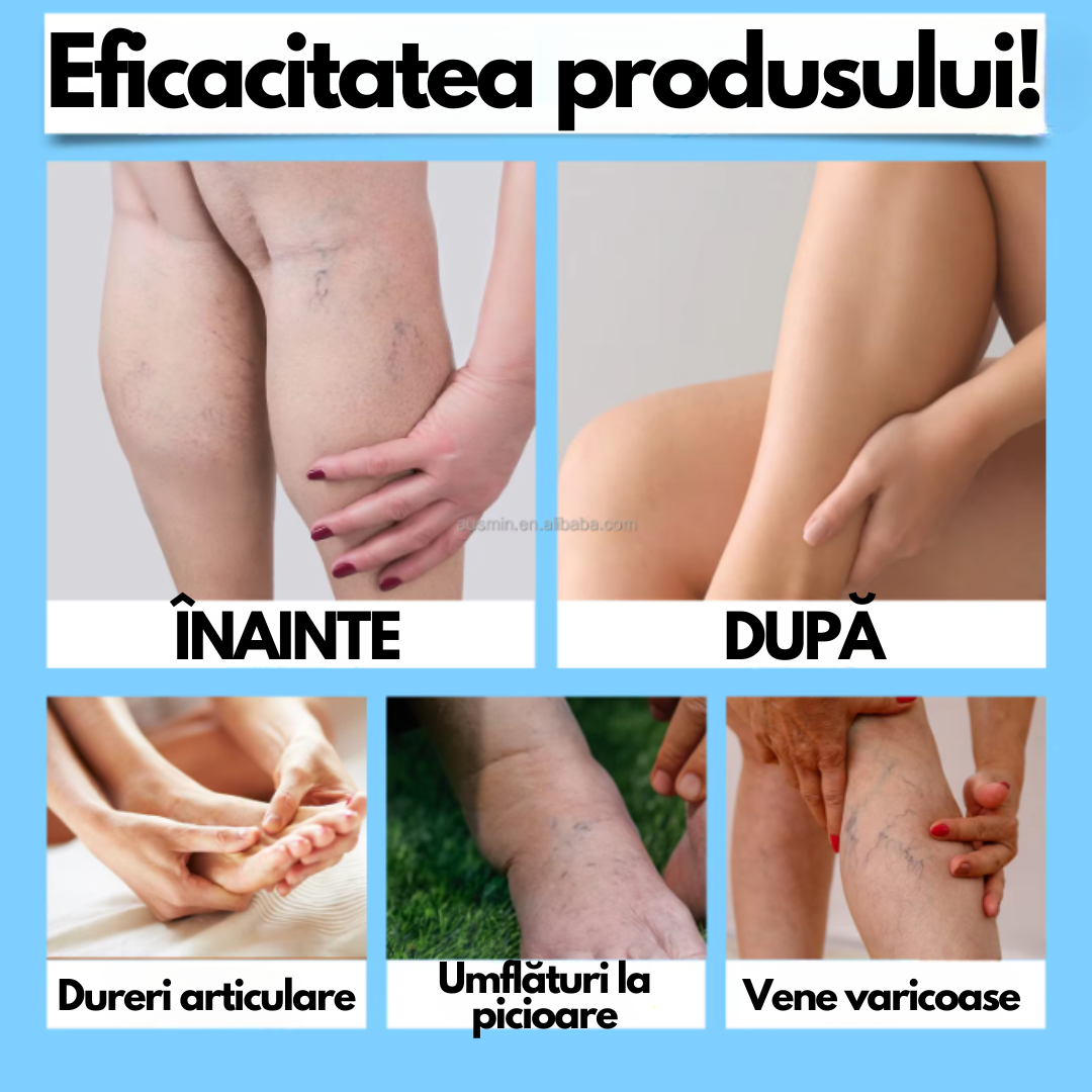 VarixCalm – Spray pentru varice