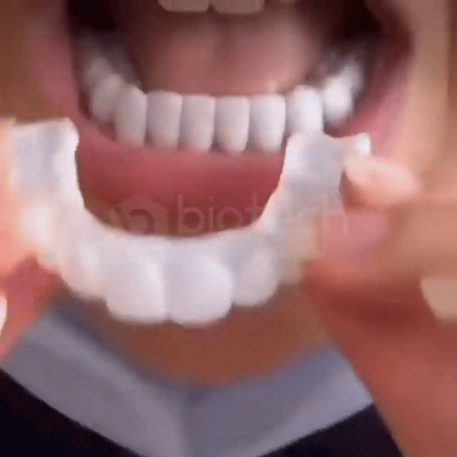 MagicSmile™-Dinți falși cu aspect natural