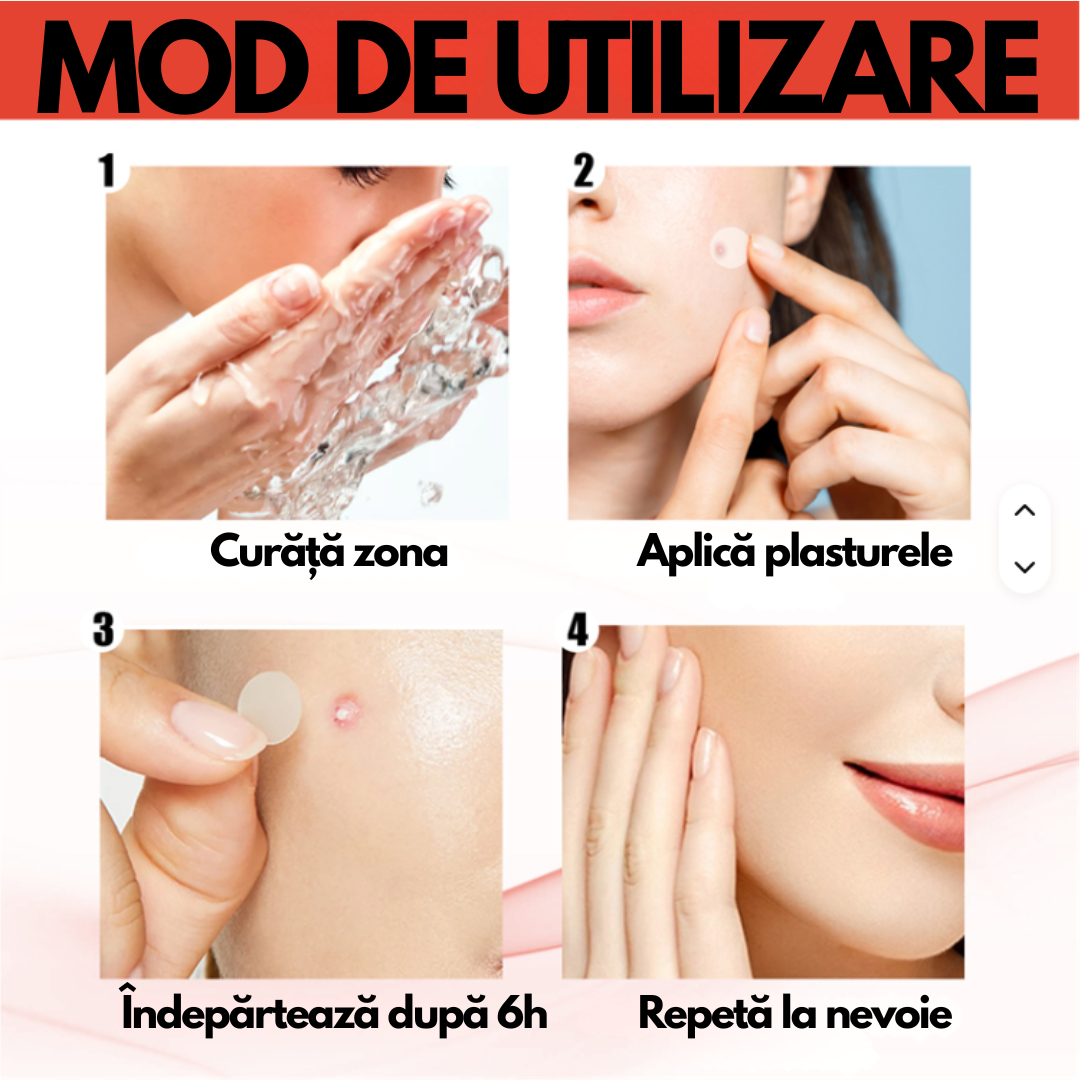 DermaClear® – Plasturi anti-negi și papiloame