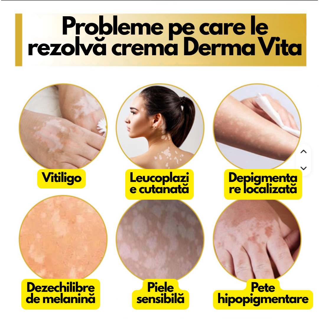 Derma Vita – Cremă pentru Vitiligo