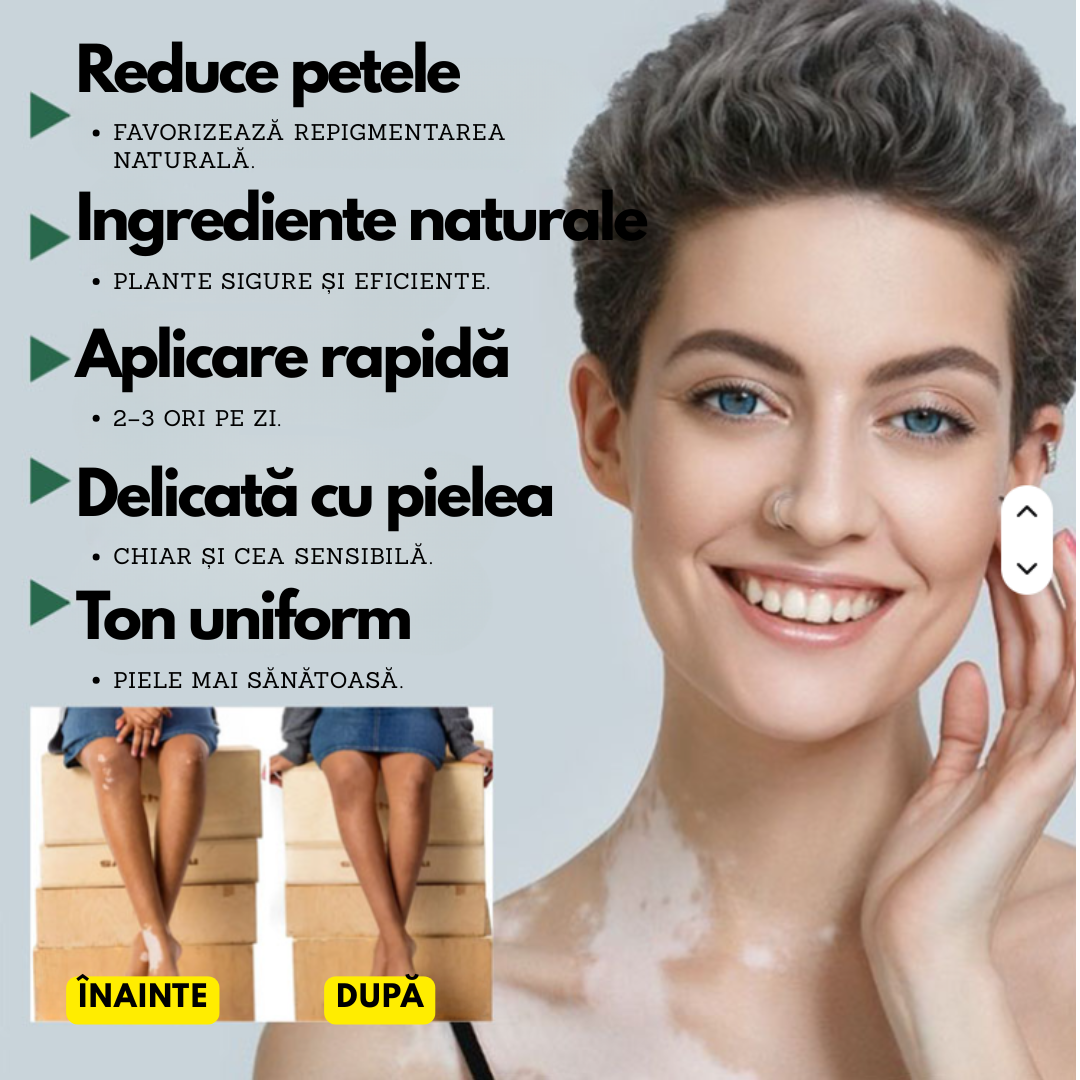Derma Vita – Cremă pentru Vitiligo