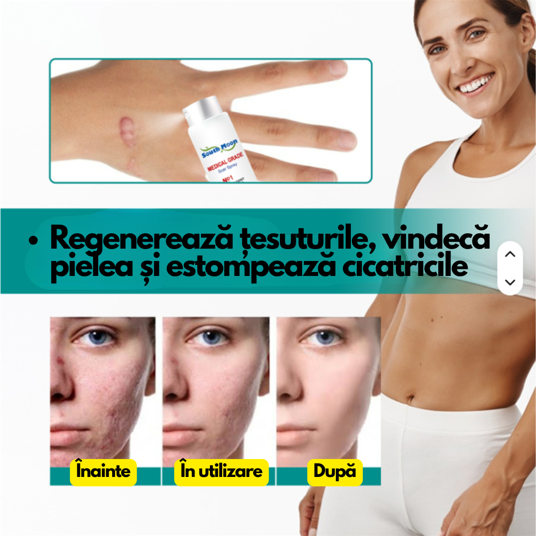 CicaStop – Spray Anti-Cicatrici