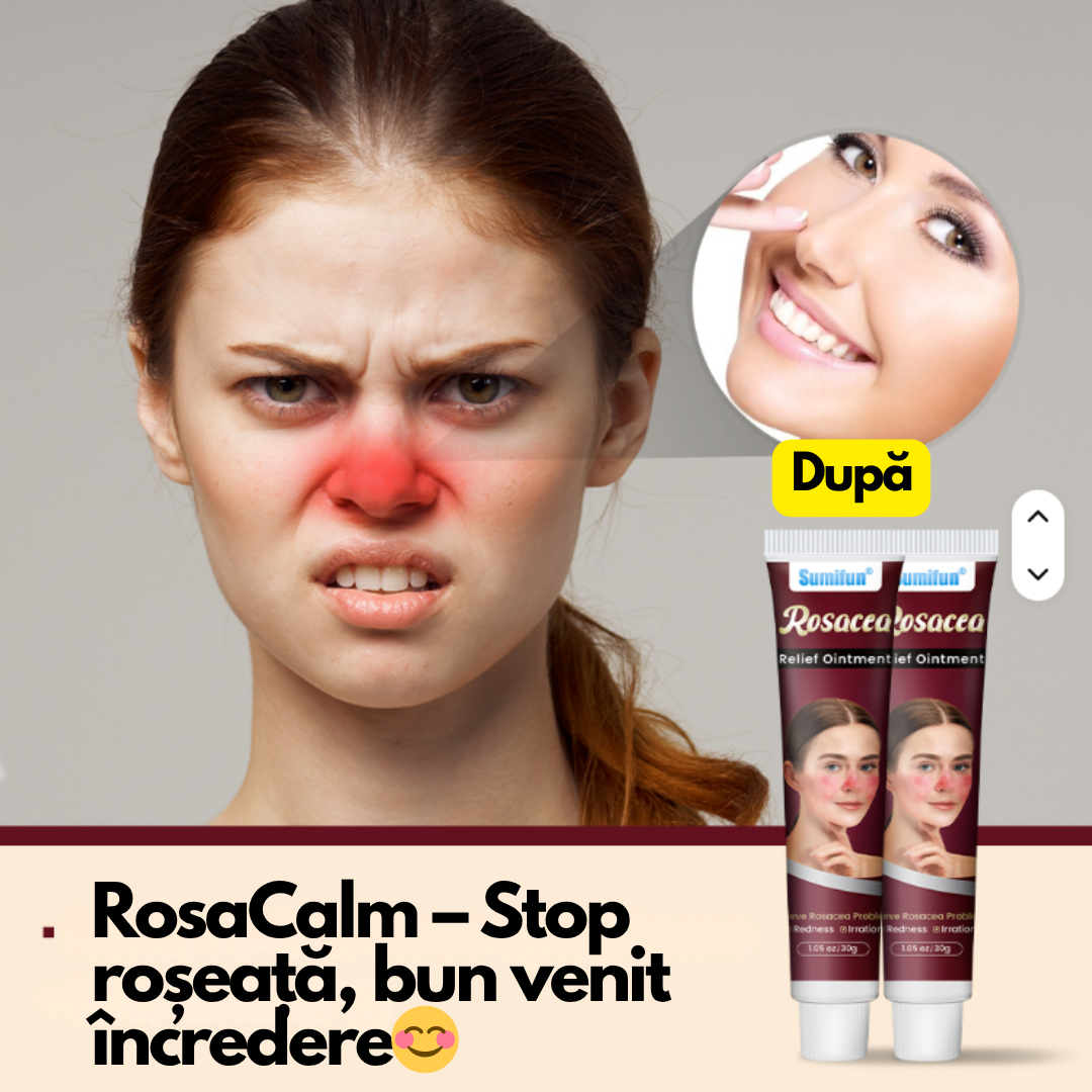 RosaCalm – Cremă pentru roșeață și cuperoză