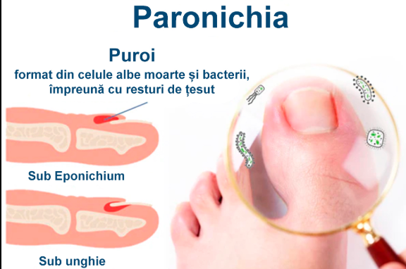 Ulei pentru regenerarea unghiilor