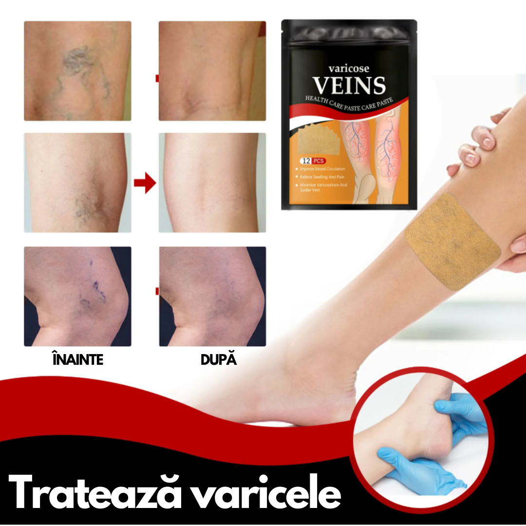 Plasturi Anti-Varice cu Turmeric