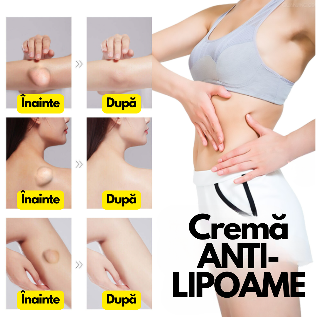 LipoStop – Cremă ANTI-LIPOAME
