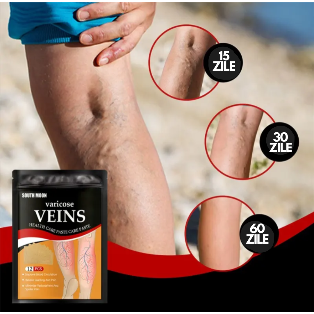 Plasturi Anti-Varice cu Turmeric