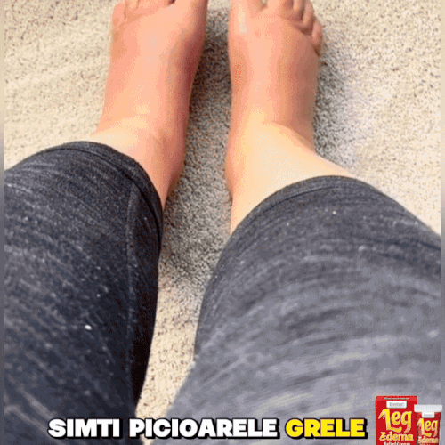 EdemaStop – Cremă pentru picioare ușoare, fără umflături