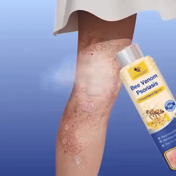 🐝 BeeCalm – Spray calmant pentru psoriazis