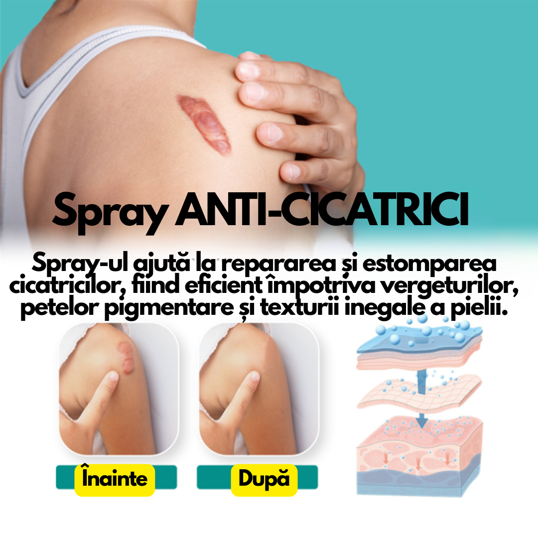CicaStop – Spray Anti-Cicatrici